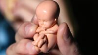 ilustrasi aborsi