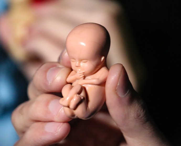 ilustrasi aborsi